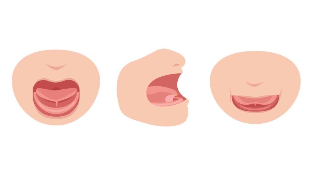 Você sabe avaliar se a anquiloglossia (língua presa) do bebê está atrapalhando a mamada?
